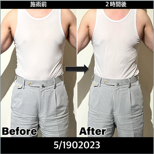 60歳男性のお客様